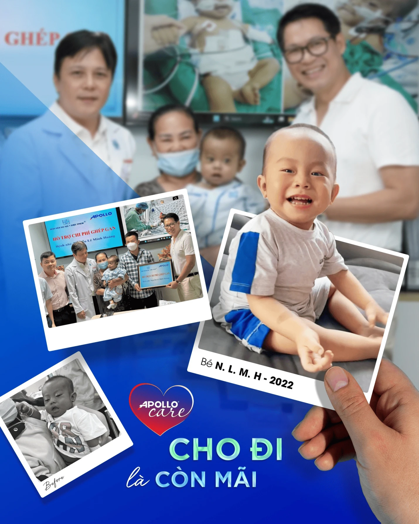 Nhìn lại hành trình một năm hồi sinh của bé N.L.M.H trong dự án mổ tim và ghép gan Apollo Care